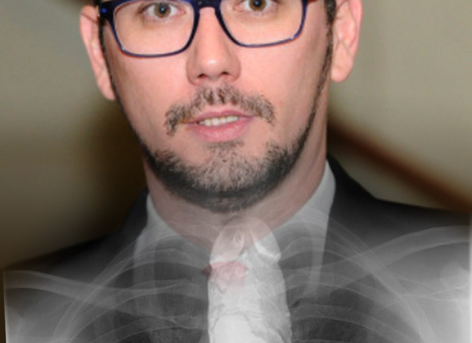 Byla dokázána existence páteře Jiřího Ovčáčka. Má ji zaraženou hluboko v řiti!
